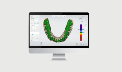 TRIOS Patient Monitoring