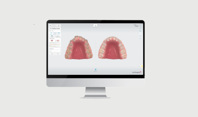 TRIOS Treatment Simulator